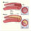 Coronary Artery Disease (CAD)